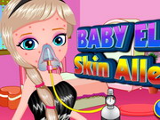 Play Baby Elsa Skin Allergy
