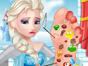 Play Elsa Foot Doctor Game