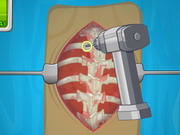 Play Operate Now: Scoliosis Surgery