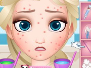 Play Squeeze Elsa Pimples